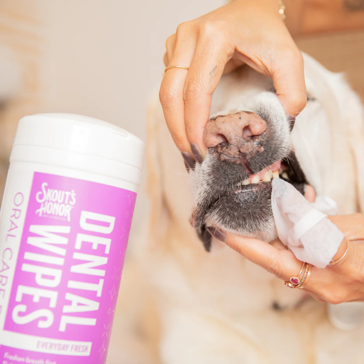 Dental Wipes